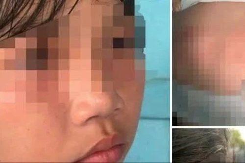 Bình Thuận: Tạm dừng việc học nữ sinh đánh bạn ngay trong trường
