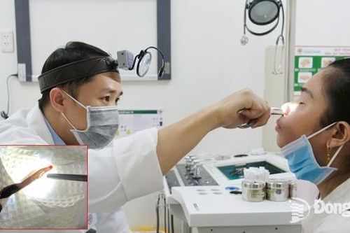 Gắp con vắt dài 8cm trong mũi nữ bệnh nhân ở Biên Hòa