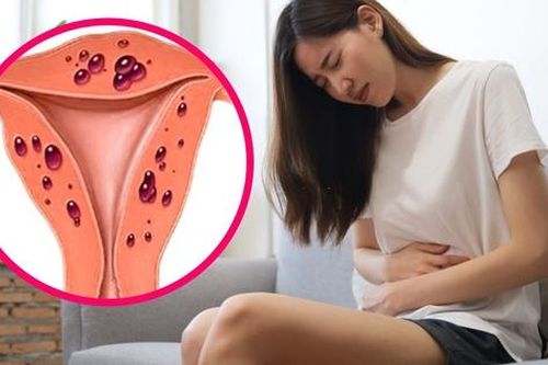 Phụ nữ bị rối loạn phụ khoa dễ có nguy cơ mắc bệnh tim