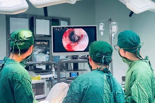 Phẫu thuật nội soi lấy máu tụ – Cơ hội hồi sinh cho bệnh nhân xuất huyết não