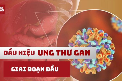 6 dấu hiệu ung thư gan giai đoạn đầu bạn phải biết