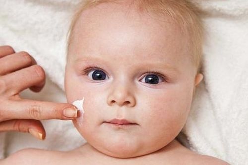 Thuốc điều trị bệnh vảy nến ở trẻ em