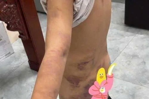 Làm rõ nghi vấn nhóm bé trai ở Hưng Yên bị bạo hành