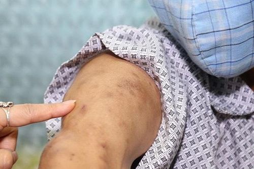 Đau như điện giật, người đàn ông bất ngờ khi biết lý do