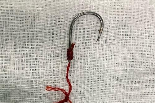 Lưỡi câu cắm sâu vào hậu môn người đàn ông sau khi ăn cá