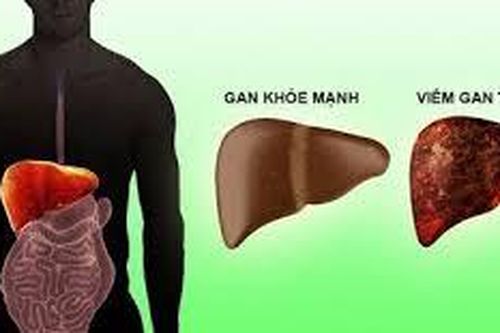 Viêm gan tự miễn có chữa được không?