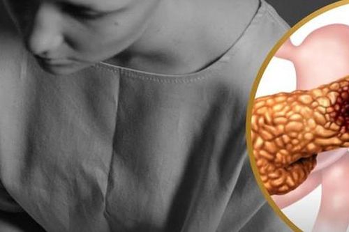 Người phụ nữ qua đời vì từ chối điều trị ung thư, tin vào thực dưỡng