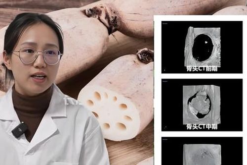 Thực hư chuyện các 'pháp sư Trung Hoa' dùng củ sen tái tạo cơ thể như Na Tra