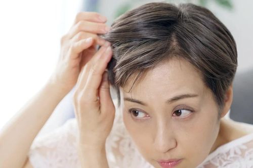 Thiếu 3 loại dinh dưỡng quan trọng này khiến tóc bạc sớm