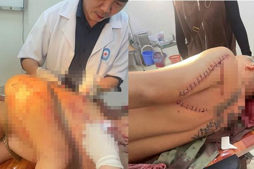 Bị người chung vốn làm ăn chém