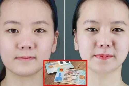 Nâng mũi, cắt mí có phải làm lại căn cước không?