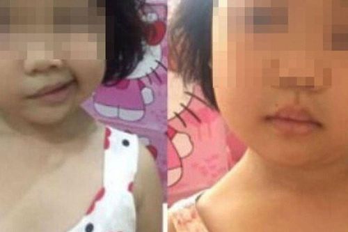 Con gái 4 tuổi méo miệng khi vừa ngủ dậy, mẹ tưởng bị đột quỵ hóa ra do sai lầm khi dùng điều hòa