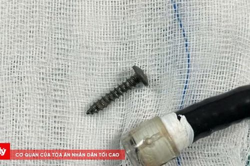 Quảng Trị: Bé trai 34 tháng tuổi nuốt đinh vít khi chơi