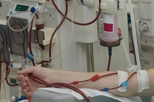 Sở Y tế TP.HCM: Lọc máu thải độc, ngừa đột quỵ là không có cơ sở