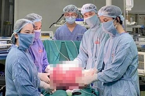 3 giờ phẫu thuật lấy khối u buồng trứng nặng 15kg cho nữ bệnh nhân