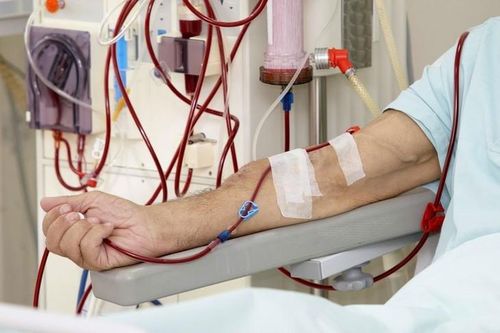 Sở Y tế TP.HCM: Chưa có bằng chứng khoa học về lọc máu phòng được đột quỵ