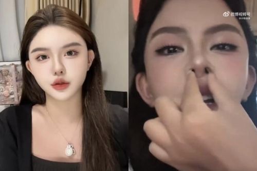 Ngôi sao mạng phải dùng tay nong mũi để dễ thở vì 'dao kéo' quá nhiều