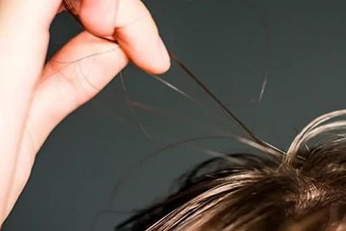 Hội chứng nghiện giật tóc: Nguyên nhân, biểu hiện, cách điều trị và phòng bệnh