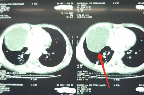 Bé trai phát hiện bệnh hiếm sau một cú ngã