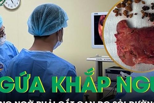 Ngứa khắp người tưởng bệnh ngoài da, không ngờ phải cắt gan vì sỏi đường mật