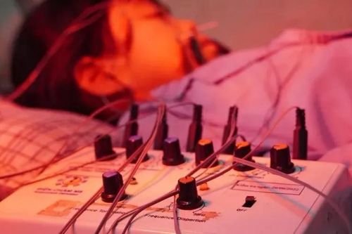 Méo miệng, mắt không thể nhắm kín sau lần tắm muộn khi uống rượu