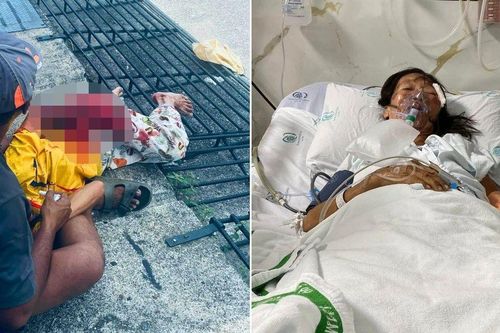 Thái Lan: Người phụ nữ mất tay sau khi vướng áo vào bánh xe