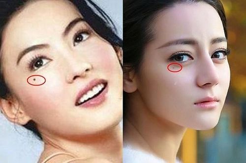 10 nốt ruồi lận đận: Ai có một đời xui xẻo, dễ tai ương