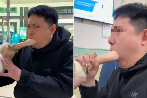 Clip: Đu trend 'ăn tay', cặp đôi phải cầu cứu bác sĩ trong tình trạng 'miệng tay dính liền'