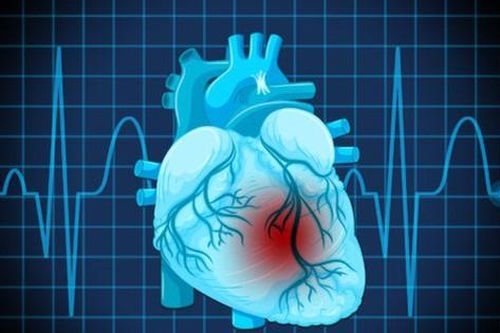 Dấu hiệu cảnh báo rối loạn nhịp tim