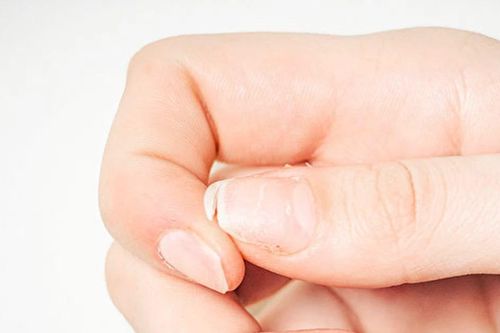 5 dấu hiệu bất thường ở móng tay báo hiệu tình trạng sức khỏe