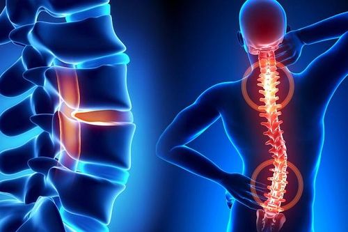 Điều trị chấn thương tủy sống bằng tế bào gốc