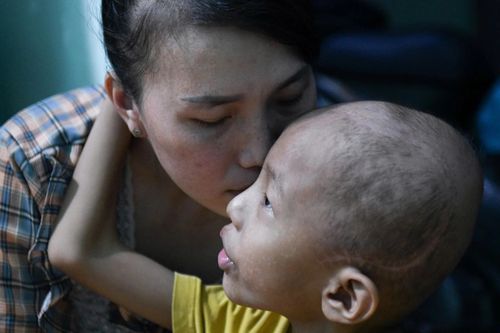 Muốn giúp trẻ bệnh nặng, hãy đến khoa ung bướu, ICU