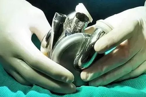 Tim nhân tạo mở ra hy vọng mới