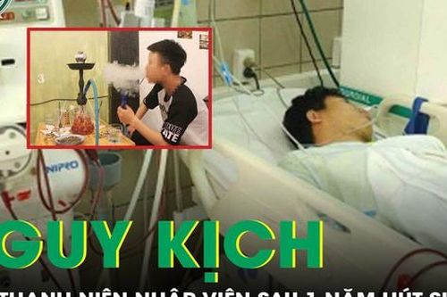 Nam thanh niên nhập viện vì xuất huyết não sau 1 năm hút shisha