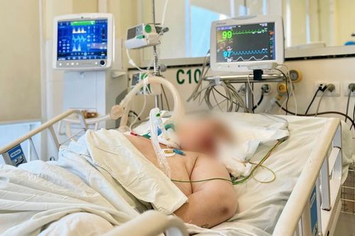 Mổ não cấp cứu người phụ nữ trẻ sau bữa nhậu