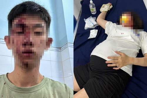 Công an vào cuộc vụ 'người phụ nữ mang bầu 8 tháng bị hành hung ở Đồng Nai'