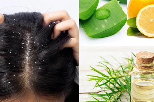 TOP dầu gội trị gàu mượt tóc, trị nấm da đầu hiệu quả nhất