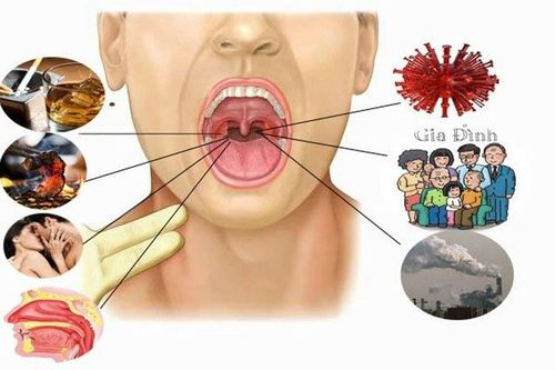 9 yếu tố nguy cơ gây nên bệnh ung thư vòm hầu hiếm gặp