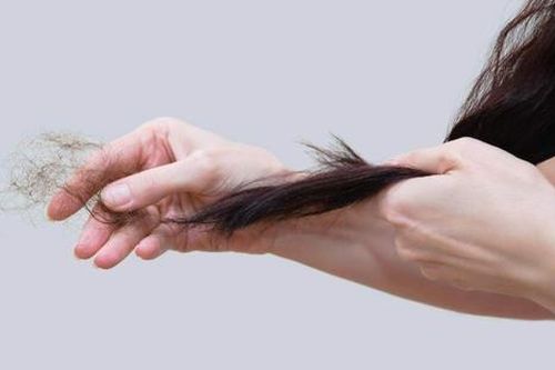 Ngưng ngay 4 thói quen này nếu không muốn tóc rụng đến mức lộ da đầu