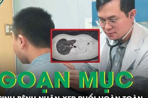 Phổi xẹp đặc như tấm bìa, người đàn ông được hồi sinh ngoạn mục