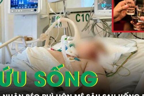 Cứu sống kỳ diệu người phụ nữ nặng hơn 100kg bị xuất huyết não, hôn mê sâu sau uống rượu