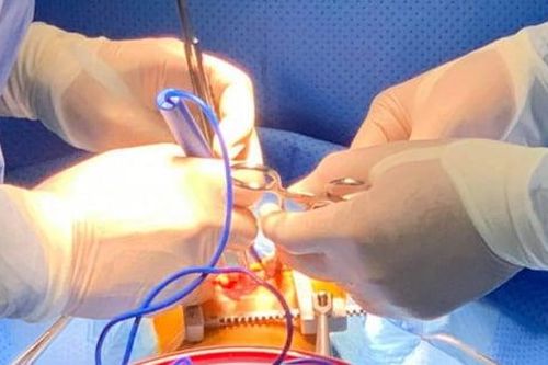Phát hiện bé 10 tháng tuổi mắc chứng tim bẩm sinh qua dấu hiệu nhiều trẻ gặp phải
