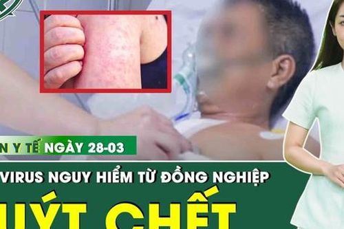 Bản tin Y tế 28/3: Người đàn ông trẻ suýt chết vì lây virus nguy hiểm từ đồng nghiệp