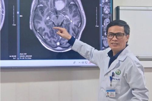 Phẫu thuật nội soi u não qua cung mày, ít xâm lấn
