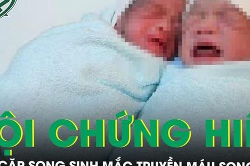 Cứu cặp song sinh mắc hội chứng hiếm gặp truyền máu song thai