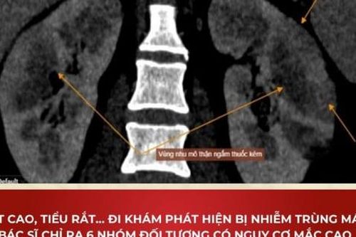 Sốt cao vào chiều tối, đi khám bất ngờ phát hiện nhiễm trùng máu