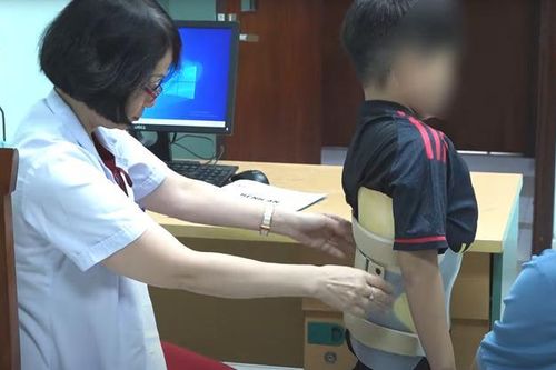 Gù cột sống: Nguyên nhân, triệu chứng, phòng ngừa và điều trị