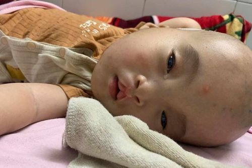 4 lần mất con, người mẹ cầu xin sự sống cho đứa còn lại bị dị tật bẩm sinh