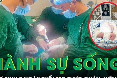 Giành sự sống cho trẻ sơ sinh 2 ngày tuổi mắc teo thực quản, viêm phổi đe dọa tính mạng