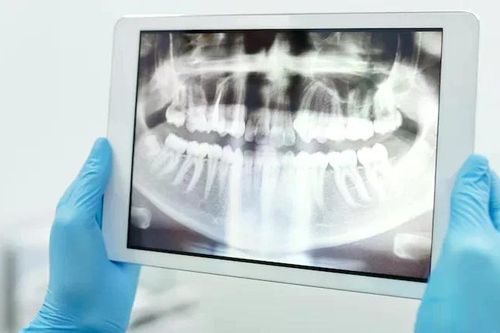 Bác sĩ nhổ nhầm răng khôn của bệnh nhân
